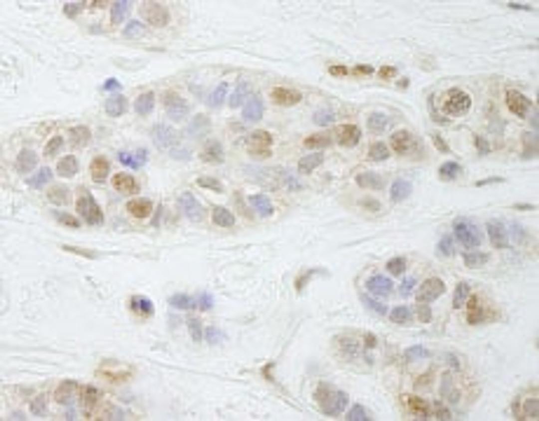 Detection of human PALB2 by immunohistochemistry.