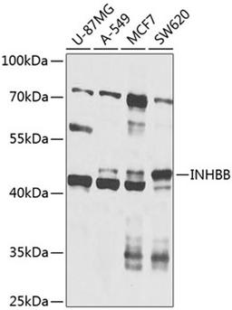 Western blot - INHBB antibody (A8553)