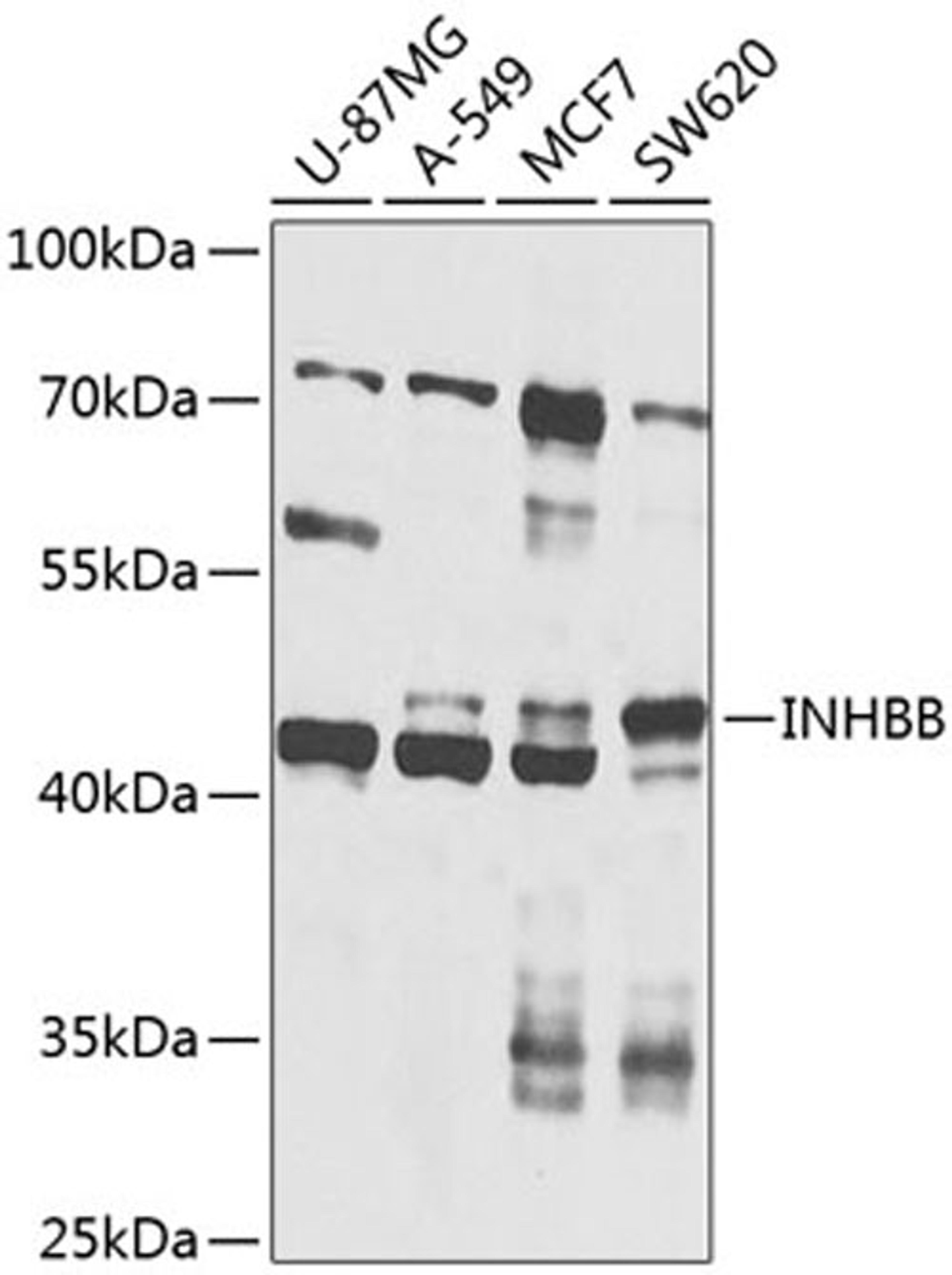 Western blot - INHBB antibody (A8553)