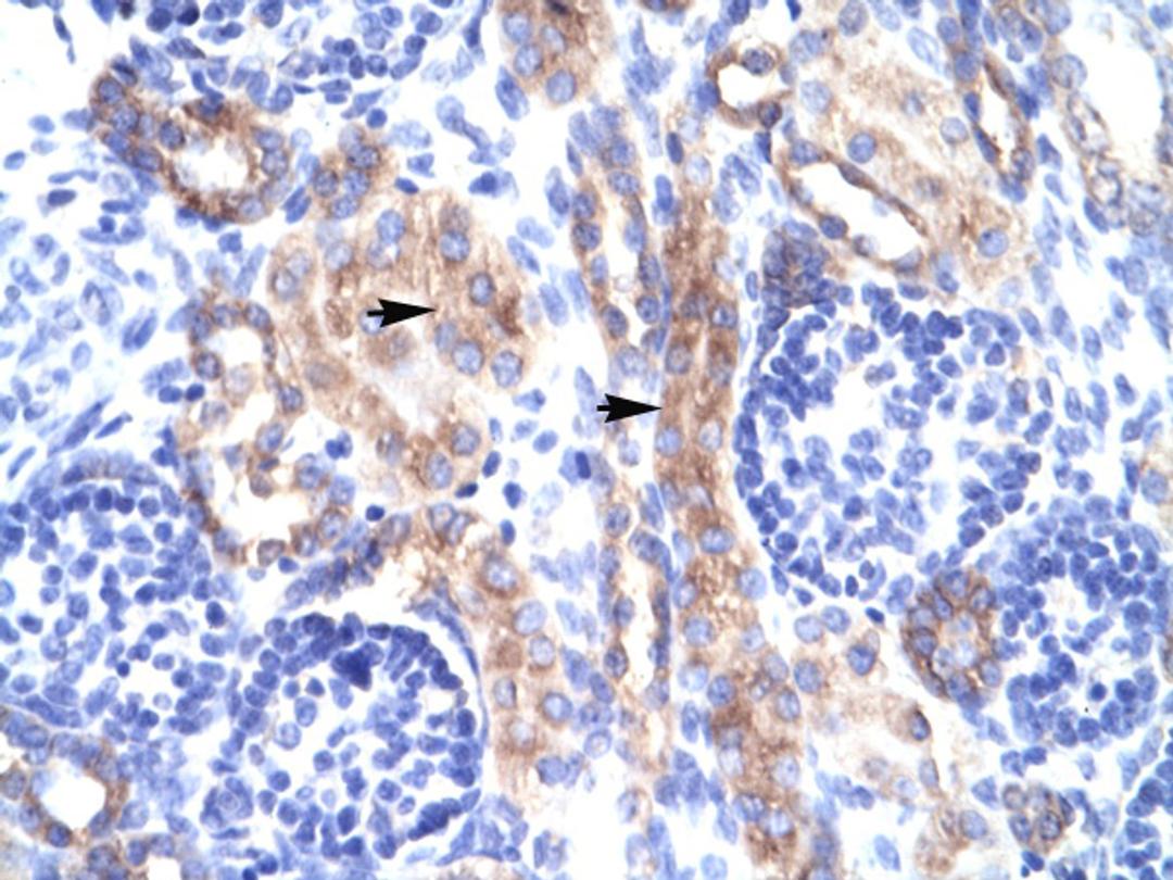 Antibody used in IHC on Human kidney.