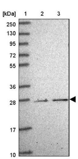 Western Blot: C9orf152 Antibody [NBP2-14423] - Lane 1: Marker [kDa] 250, 130, 95, 72, 55, 36, 28, 17, 10<br/>Lane 2: Human cell line RT-4<br/>Lane 3: Human cell line U-251MG sp