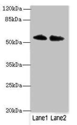 Western blot. All lanes: TRIM55 antibody at 1ug/ml. Lane 1: Hela whole cell lysate. Lane 2: Mouse liver tissue. Secondary. Goat polyclonal to rabbit IgG at 1/10000 dilution. Predicted band size: 61, 51, 27 kDa. Observed band size: 61 kDa.