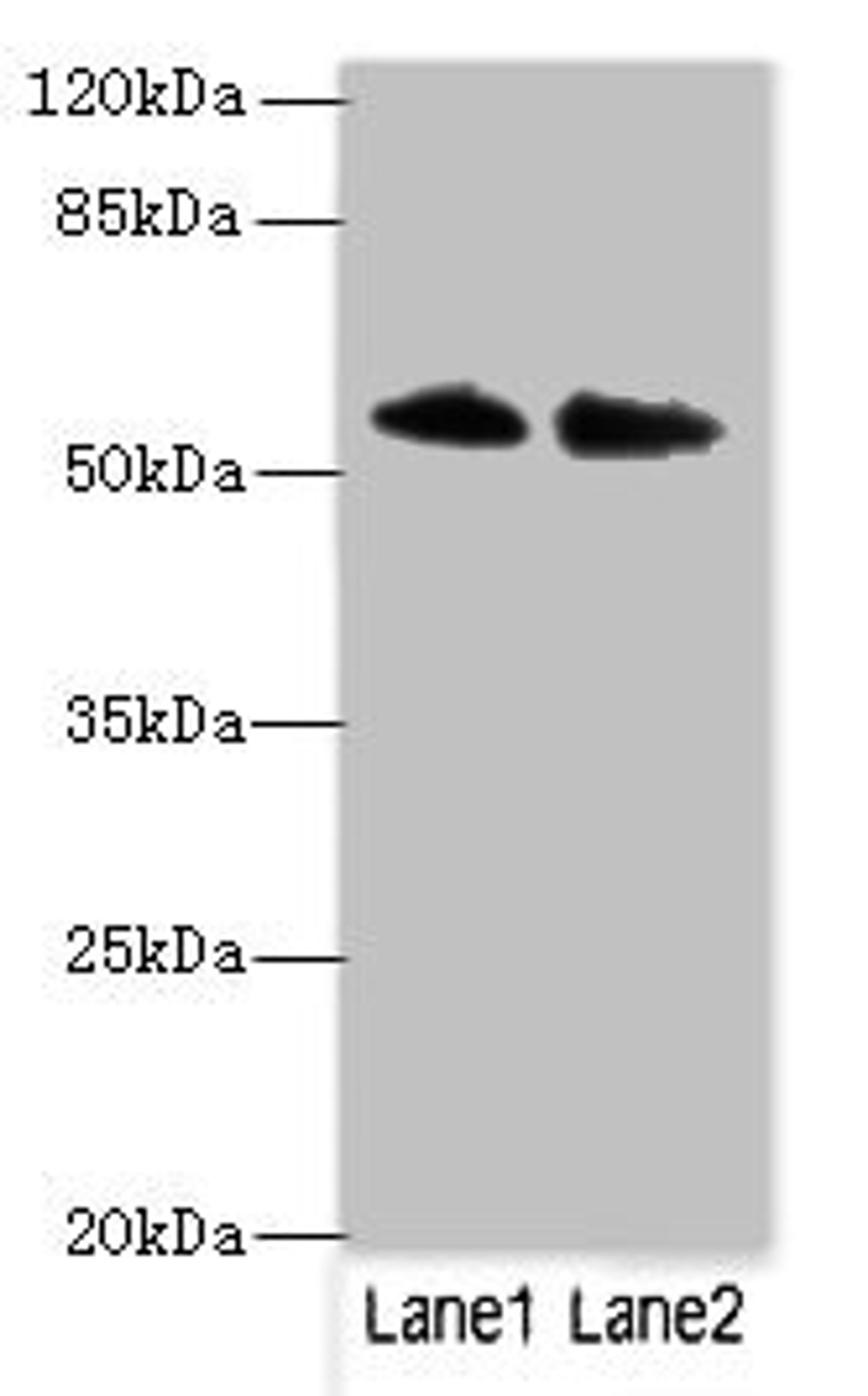 Western blot. All lanes: TRIM55 antibody at 1ug/ml. Lane 1: Hela whole cell lysate. Lane 2: Mouse liver tissue. Secondary. Goat polyclonal to rabbit IgG at 1/10000 dilution. Predicted band size: 61, 51, 27 kDa. Observed band size: 61 kDa.