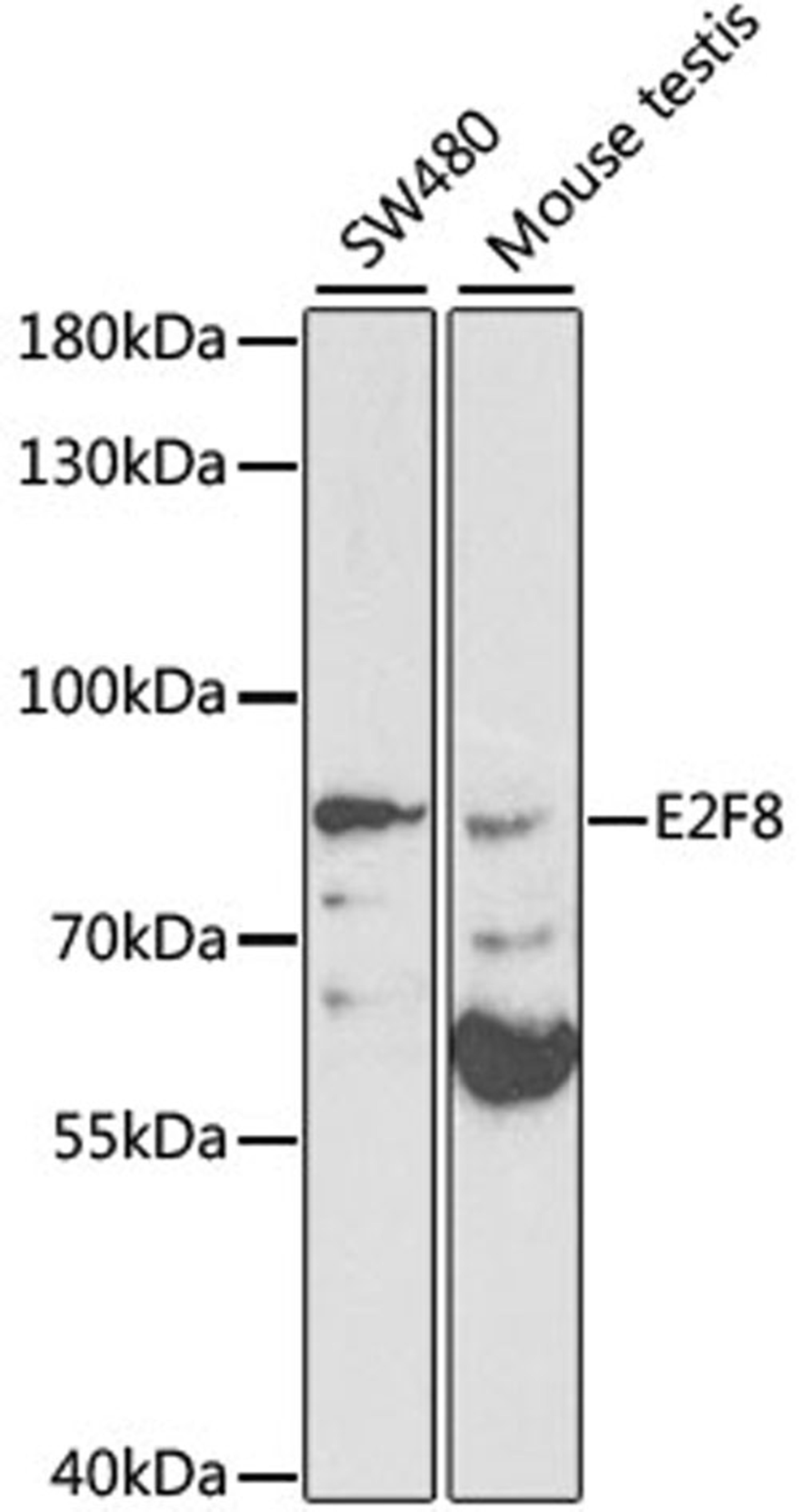 Western blot - E2F8 antibody (A1135)