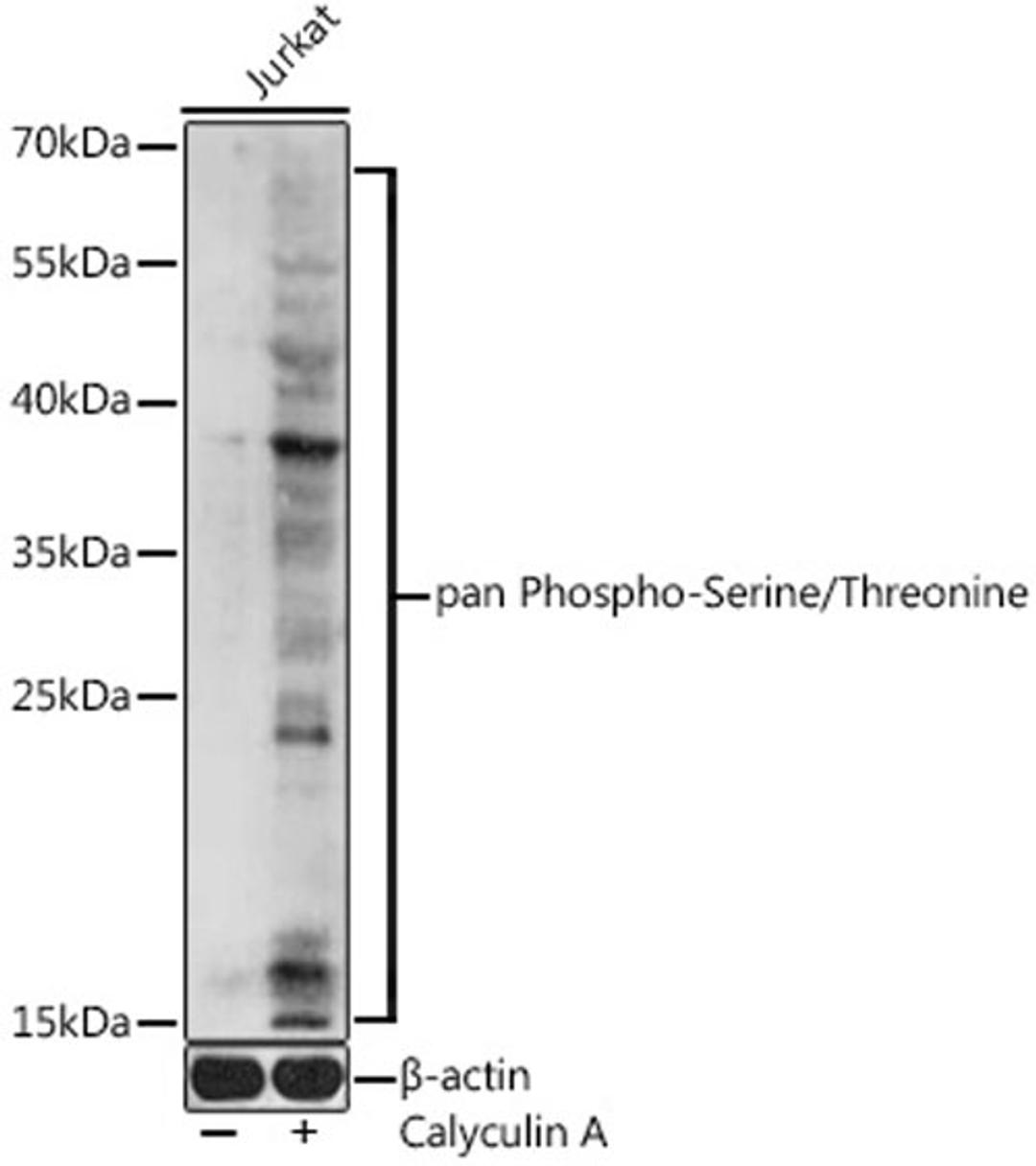 Western blot - Phospho-Ser/Thr pAb (AP0893)