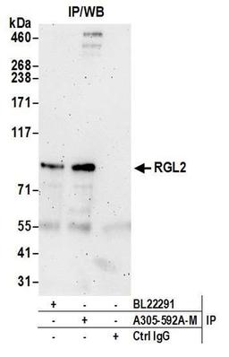 Detection of human RGL2 by WB of IP.