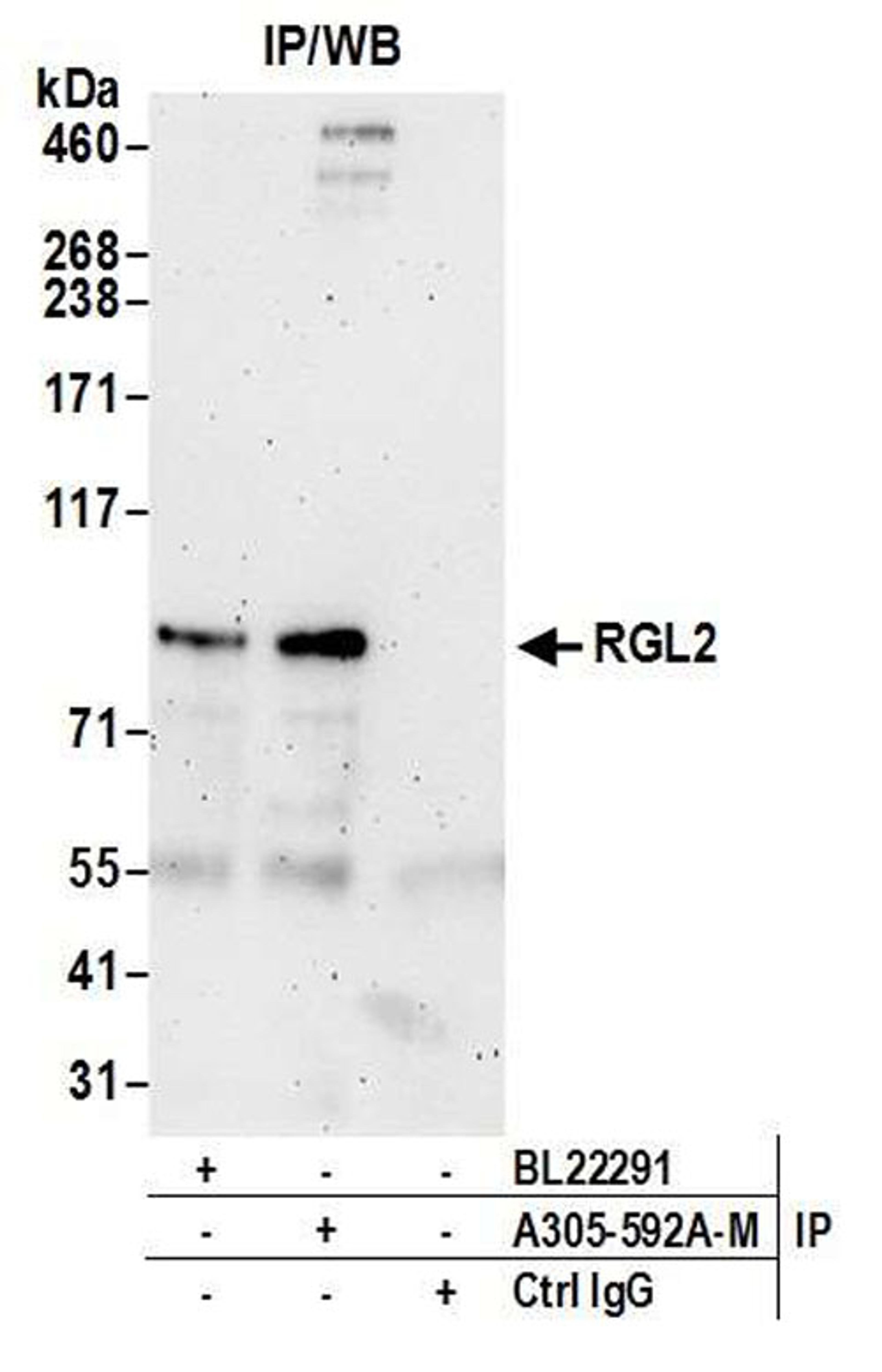 Detection of human RGL2 by WB of IP.