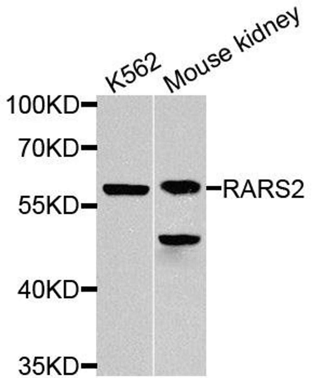 Western blot analysis of extracts of various cells using RARS2 antibody