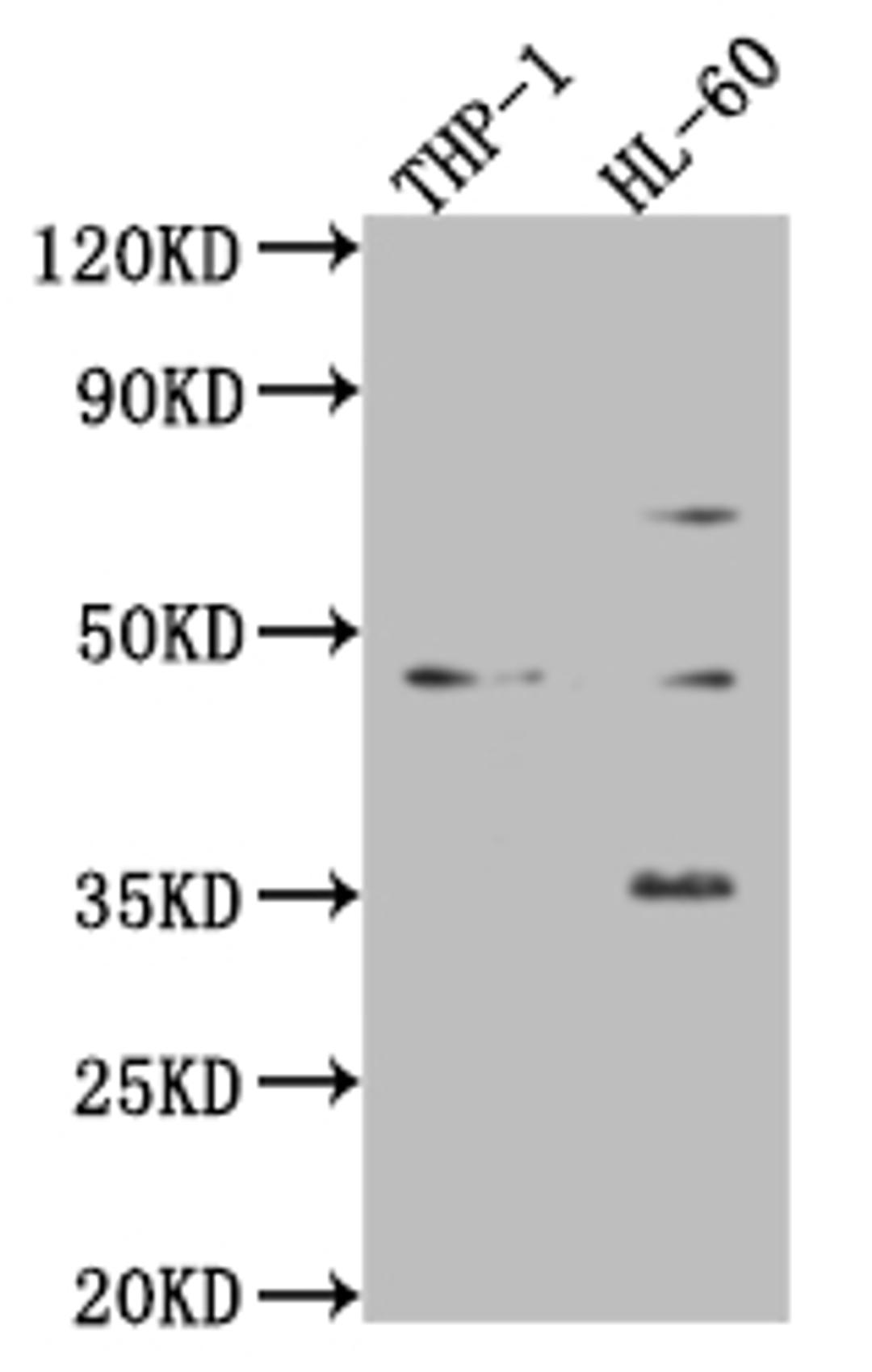 Western Blot. Positive WB detected in: Mouse heart tissue, Mouse spleen tissue, Mouse lung tissue. All lanes: ZKSCAN3 antibody at 4ug/ml. Secondary. Goat polyclonal to rabbit IgG at 1/50000 dilution. predicted band size: 61, 44 kDa. observed band size: 61, 44 kDa. 