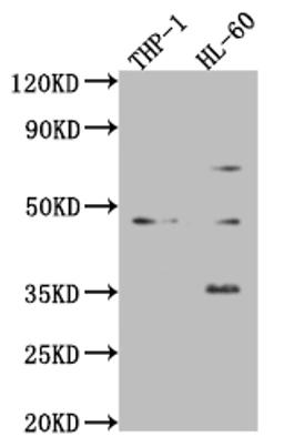Western Blot. Positive WB detected in: Mouse heart tissue, Mouse spleen tissue, Mouse lung tissue. All lanes: ZKSCAN3 antibody at 4ug/ml. Secondary. Goat polyclonal to rabbit IgG at 1/50000 dilution. predicted band size: 61, 44 kDa. observed band size: 61, 44 kDa. 