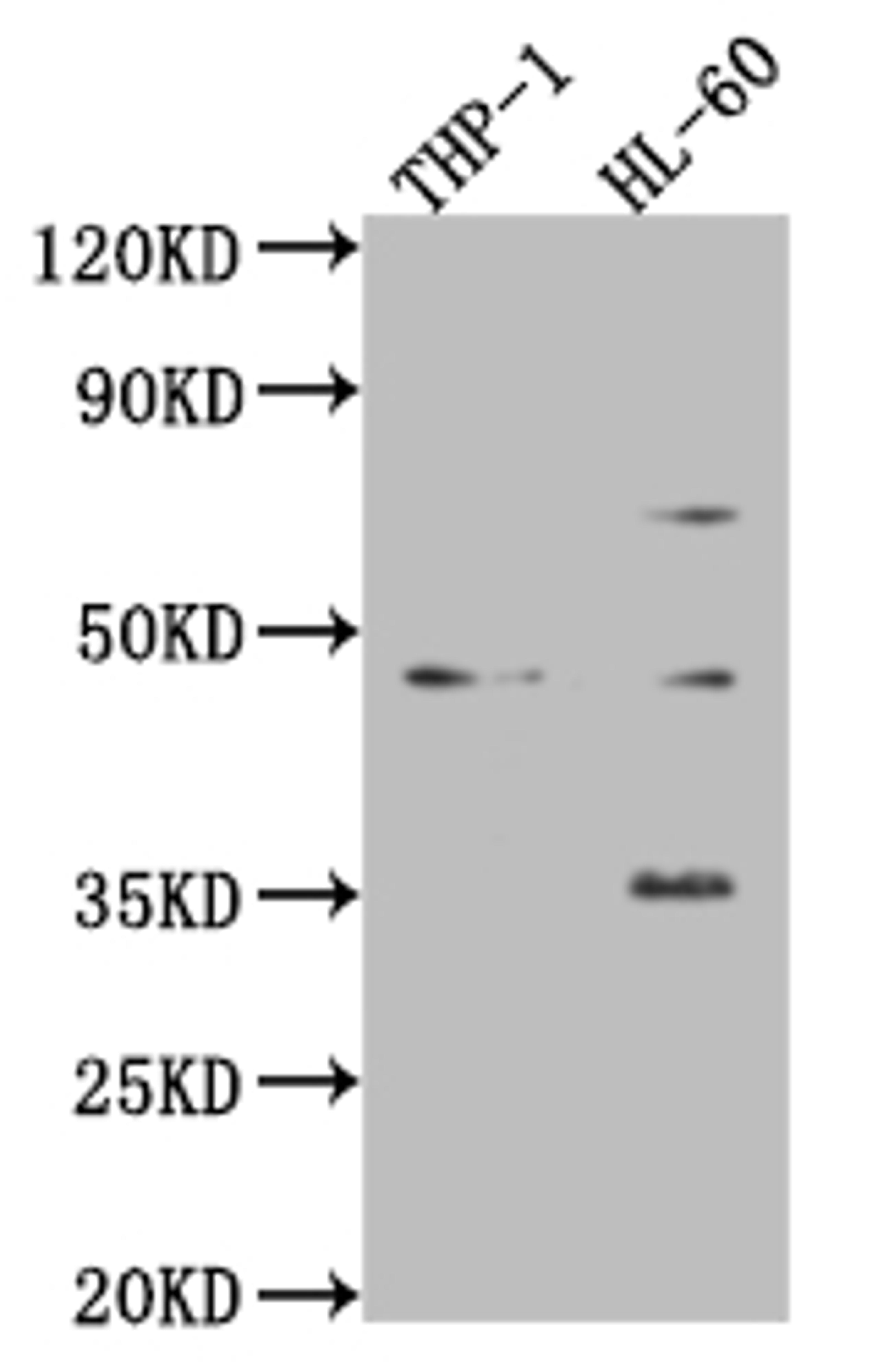 Western Blot. Positive WB detected in: Mouse heart tissue, Mouse spleen tissue, Mouse lung tissue. All lanes: ZKSCAN3 antibody at 4ug/ml. Secondary. Goat polyclonal to rabbit IgG at 1/50000 dilution. predicted band size: 61, 44 kDa. observed band size: 61, 44 kDa. 