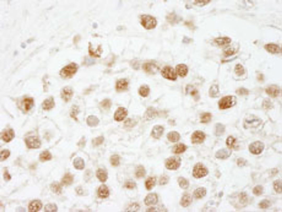 Detection of human CAF-1 p60 by immunohistochemistry.