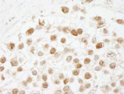 Detection of human CAF-1 p60 by immunohistochemistry.