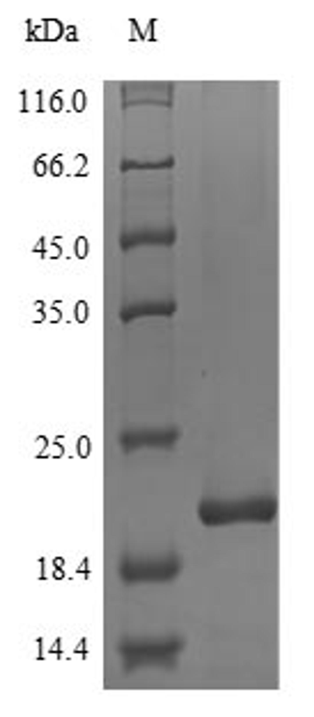(Tris-Glycine gel) Discontinuous SDS-PAGE (reduced) with 5% enrichment gel and 15% separation gel.