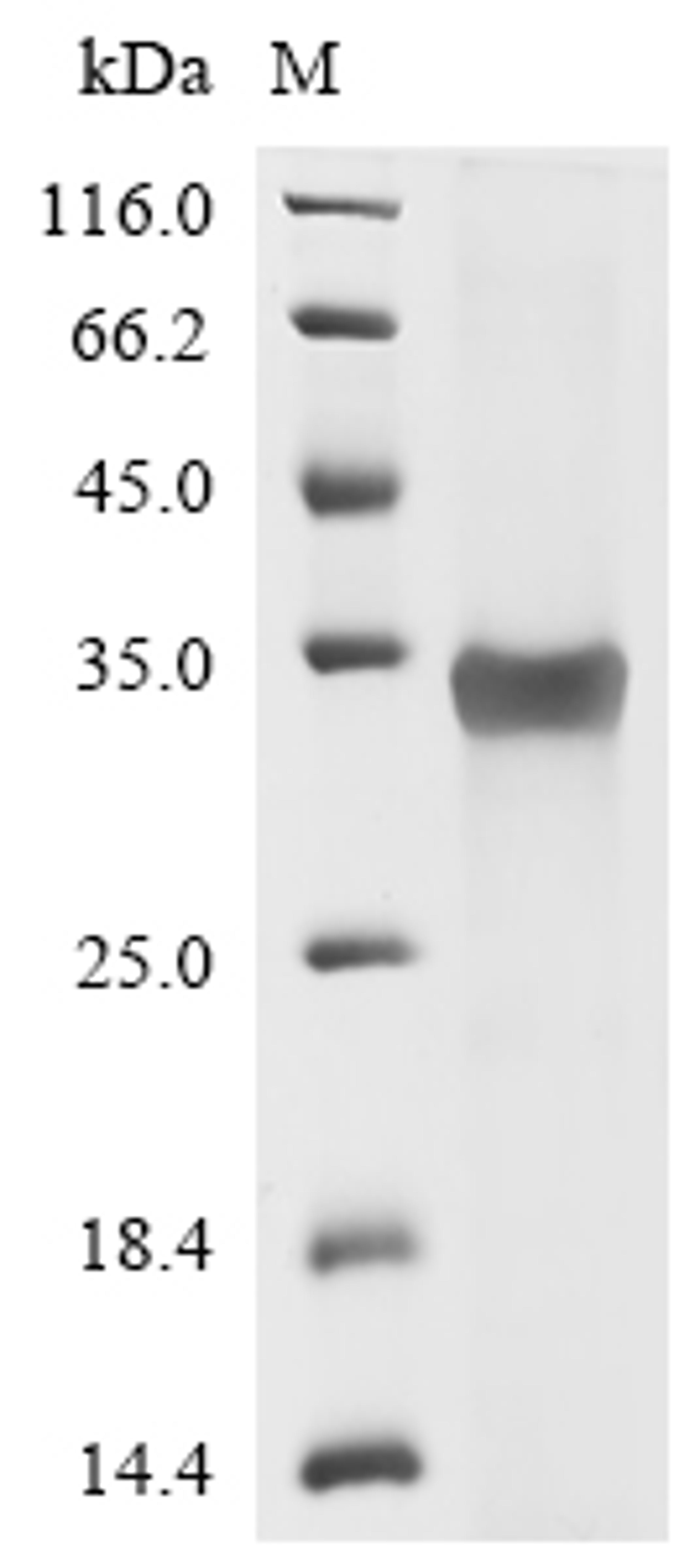 (Tris-Glycine gel) Discontinuous SDS-PAGE (reduced) with 5% enrichment gel and 15% separation gel.