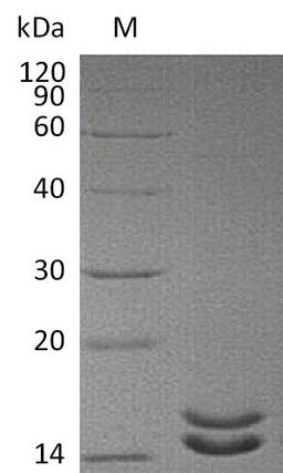 (Tris-Glycine gel) Discontinuous SDS-PAGE (reduced) with 5% enrichment gel and 15% separation gel.