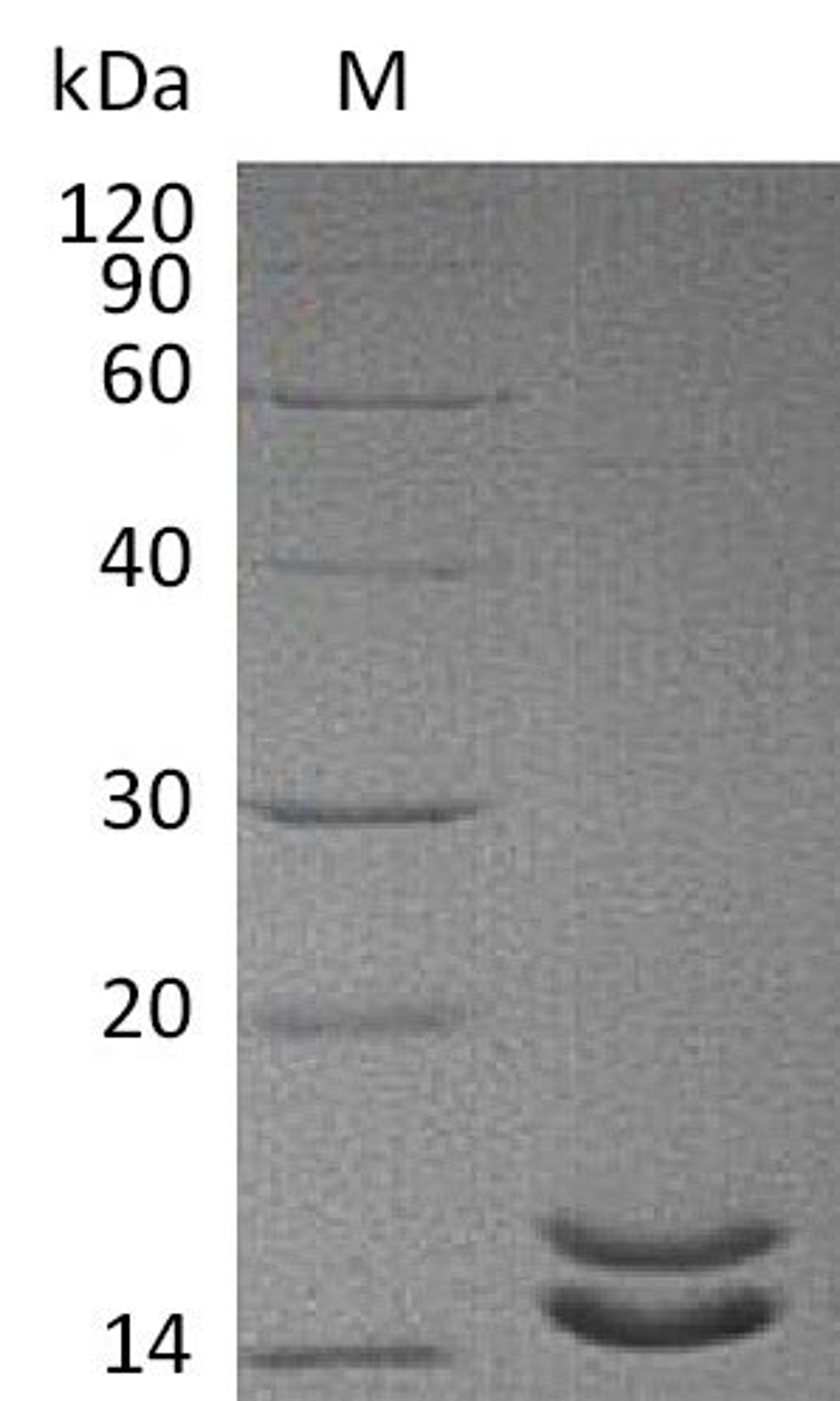 (Tris-Glycine gel) Discontinuous SDS-PAGE (reduced) with 5% enrichment gel and 15% separation gel.