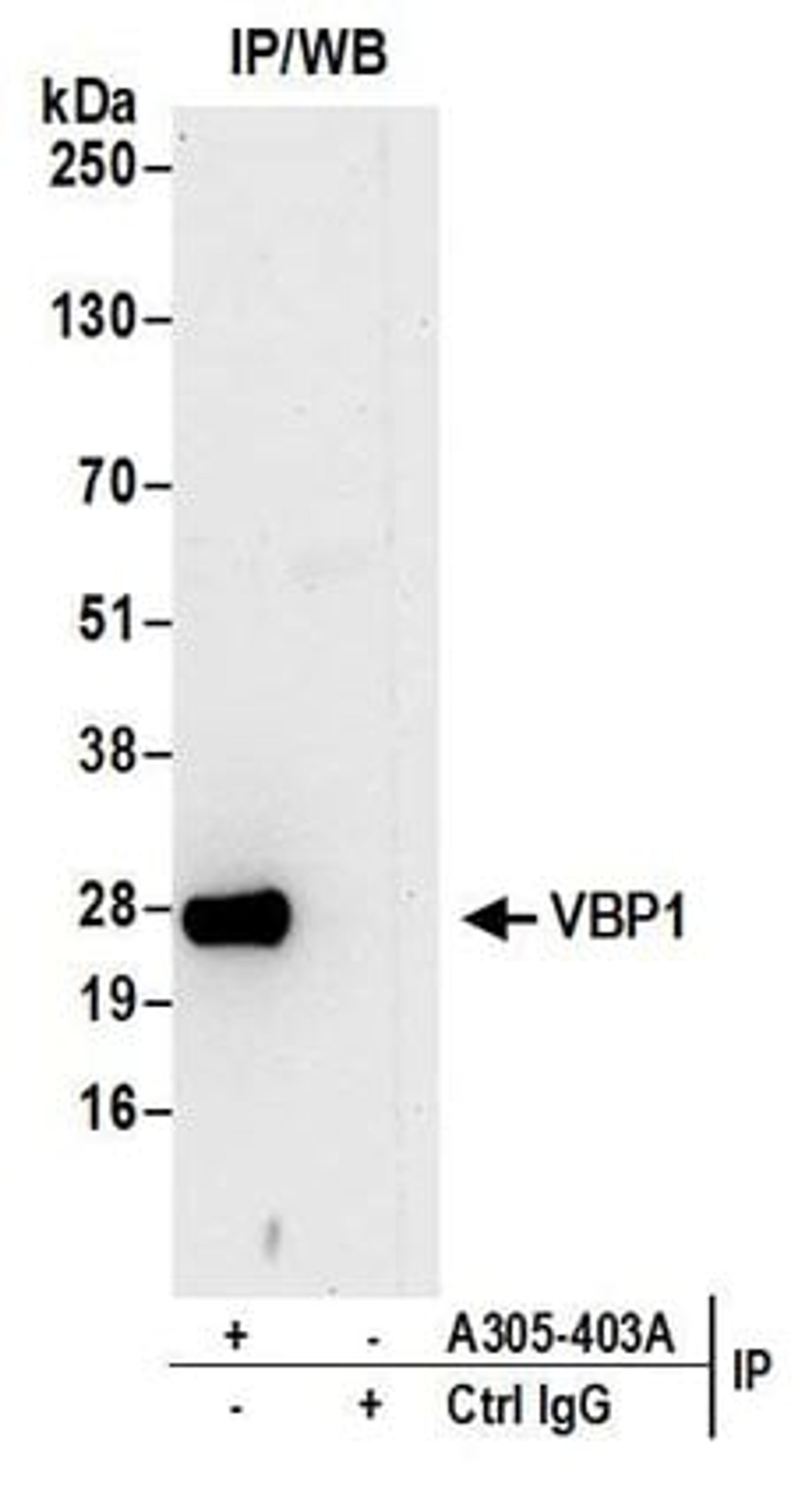 Detection of human VBP1 by western blot of immunoprecipitates.