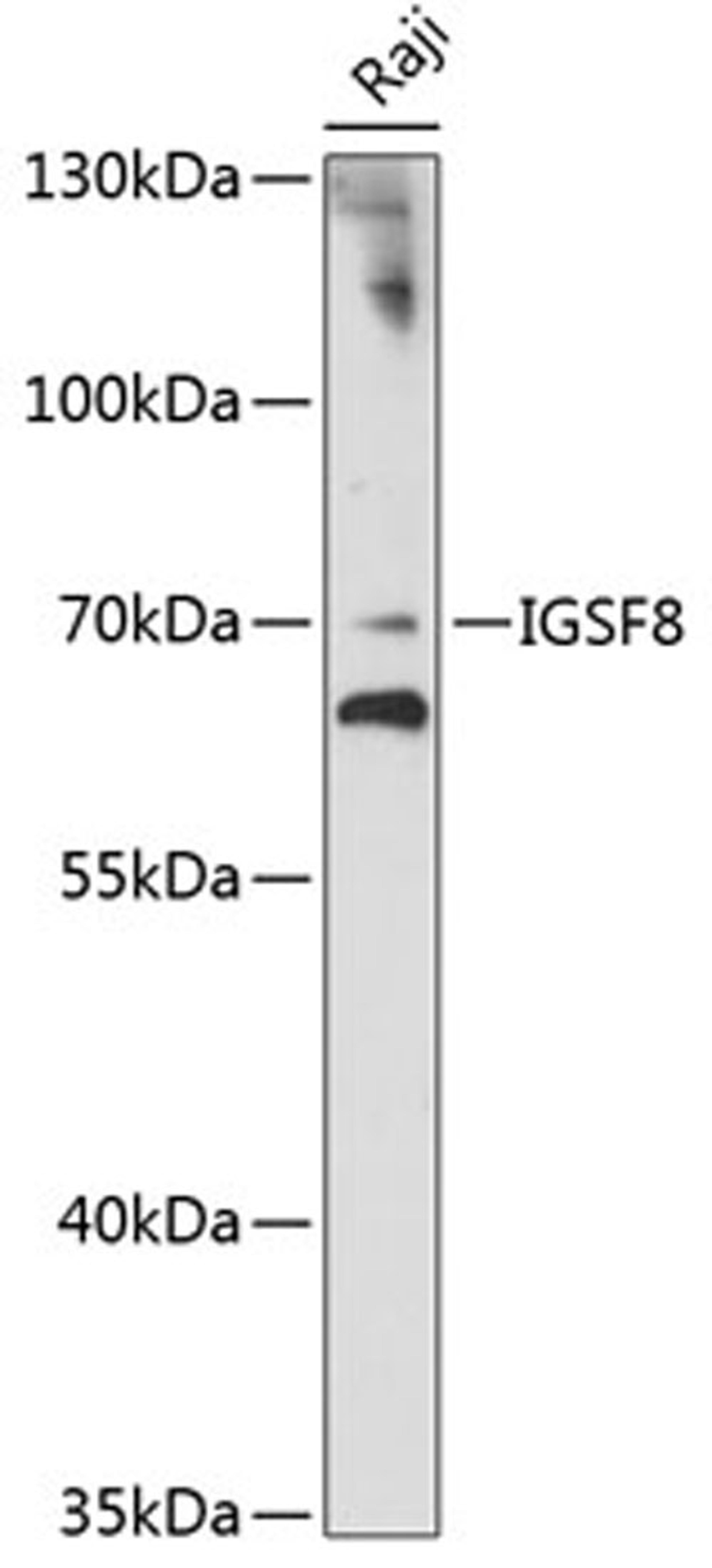 Western blot - IGSF8 antibody (A14297)