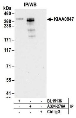 Detection of human KIAA0947 by western blot of immunoprecipitates.