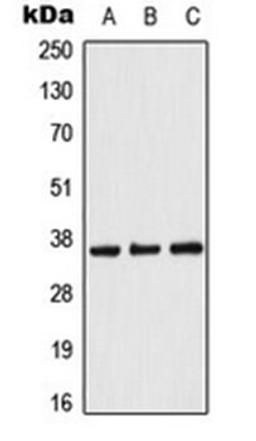 Western blot analysis of Raji (Lane 1), NIH3T3 (Lane 2), PC12 (Lane 3) whole cell lysates using ACOT8 antibody