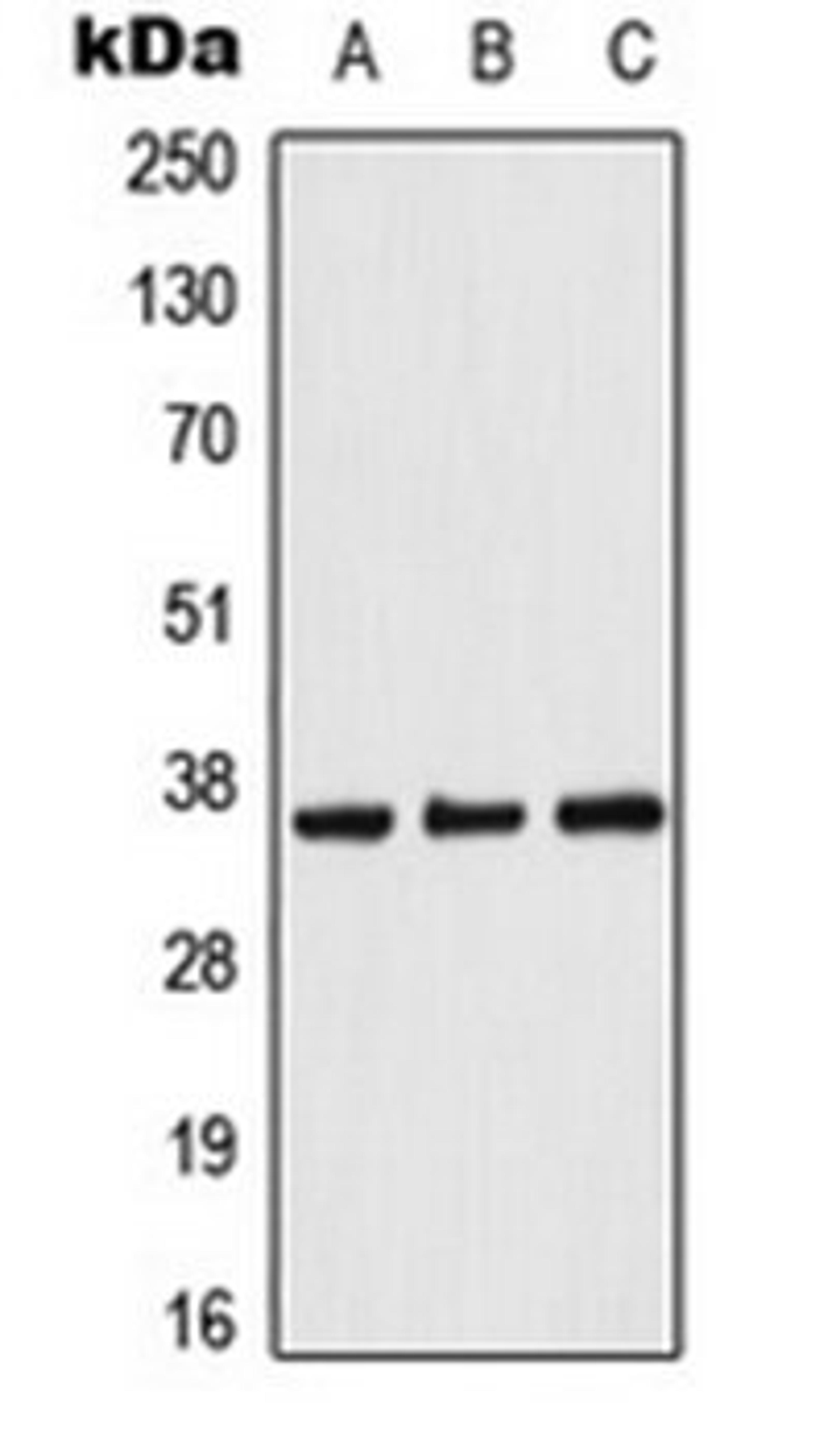 Western blot analysis of Raji (Lane 1), NIH3T3 (Lane 2), PC12 (Lane 3) whole cell lysates using ACOT8 antibody