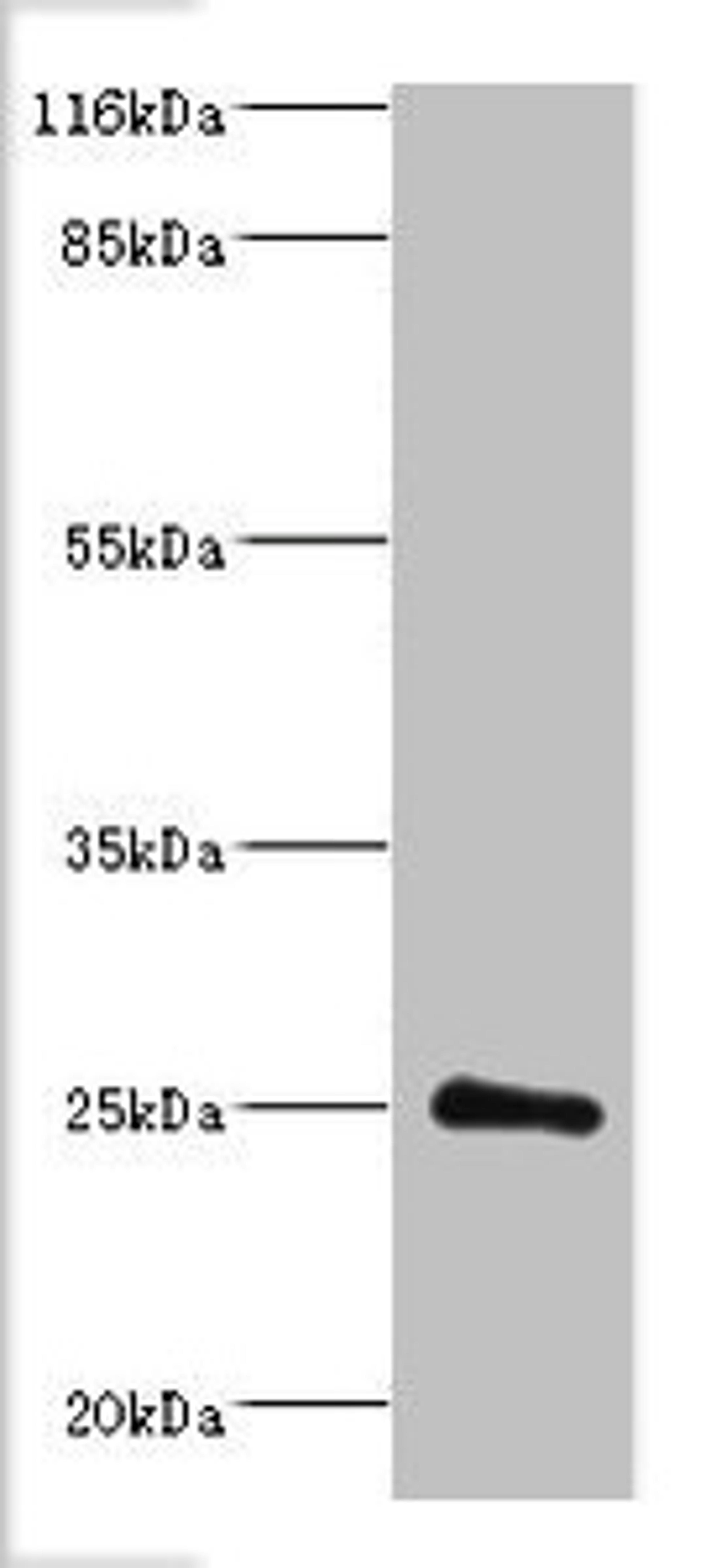 Western blot. All lanes: Protein DGCR6L antibody at 2ug/ml + Mouse brain tissue. Secondary. Goat polyclonal to rabbit IgG at 1/10000 dilution. Predicted band size: 25 kDa. Observed band size: 25 kDa. 