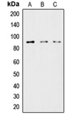 Western blot analysis of HeLa (Lane 1), MCF7 (Lane 2), COLO205 (Lane 3) whole cell lysates using LIPE antibody