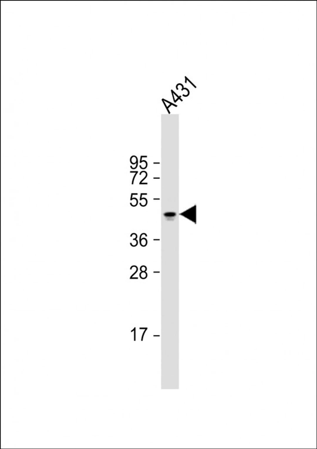 Western Blot at 1:2000 dilution + A431 whole cell lysate Lysates/proteins at 20 ug per lane.