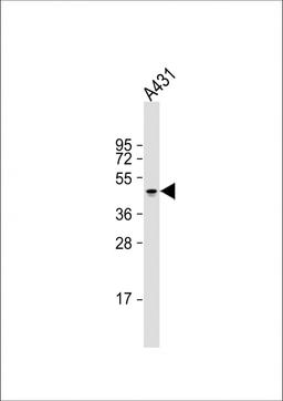 Western Blot at 1:2000 dilution + A431 whole cell lysate Lysates/proteins at 20 ug per lane.