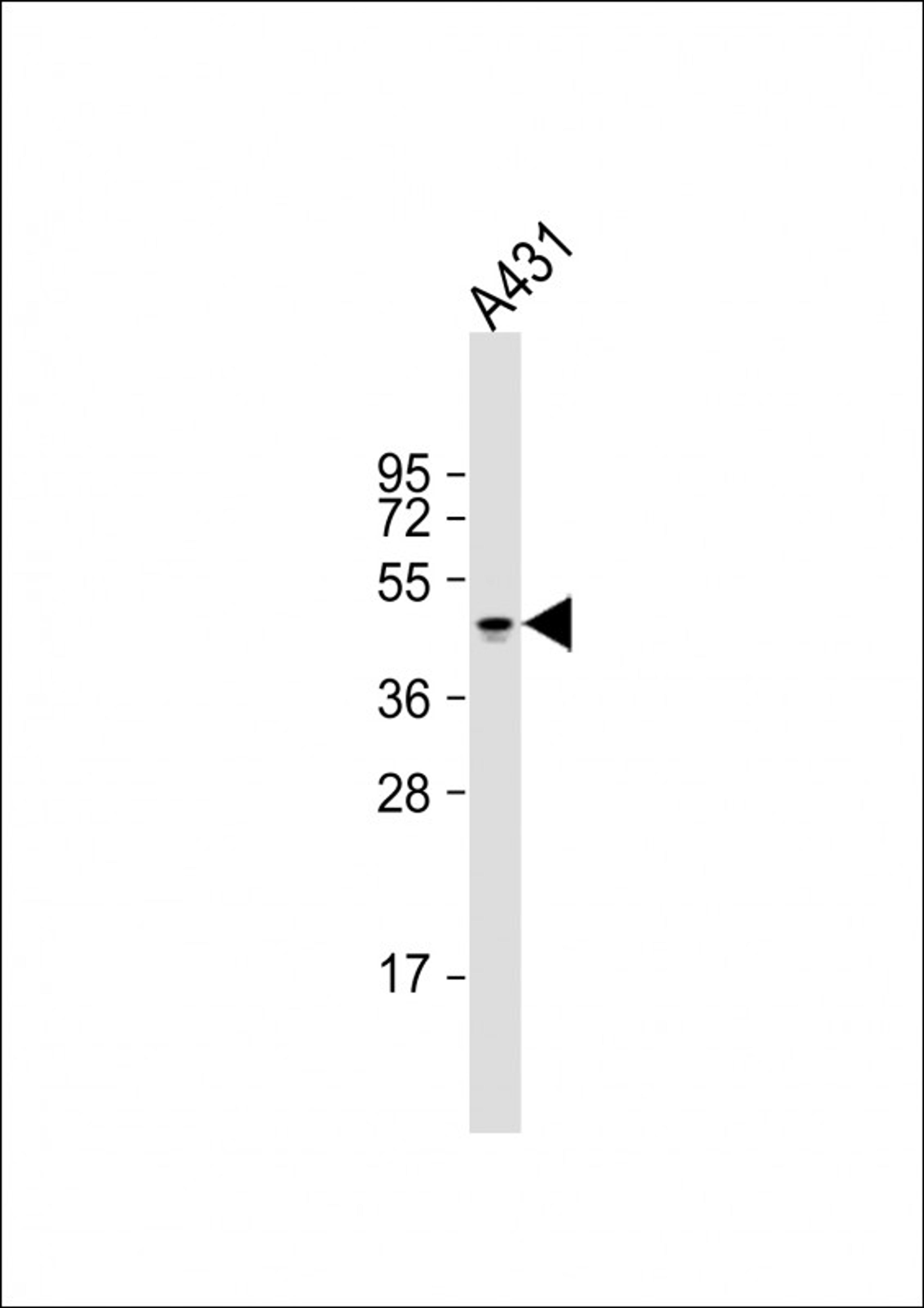 Western Blot at 1:2000 dilution + A431 whole cell lysate Lysates/proteins at 20 ug per lane.