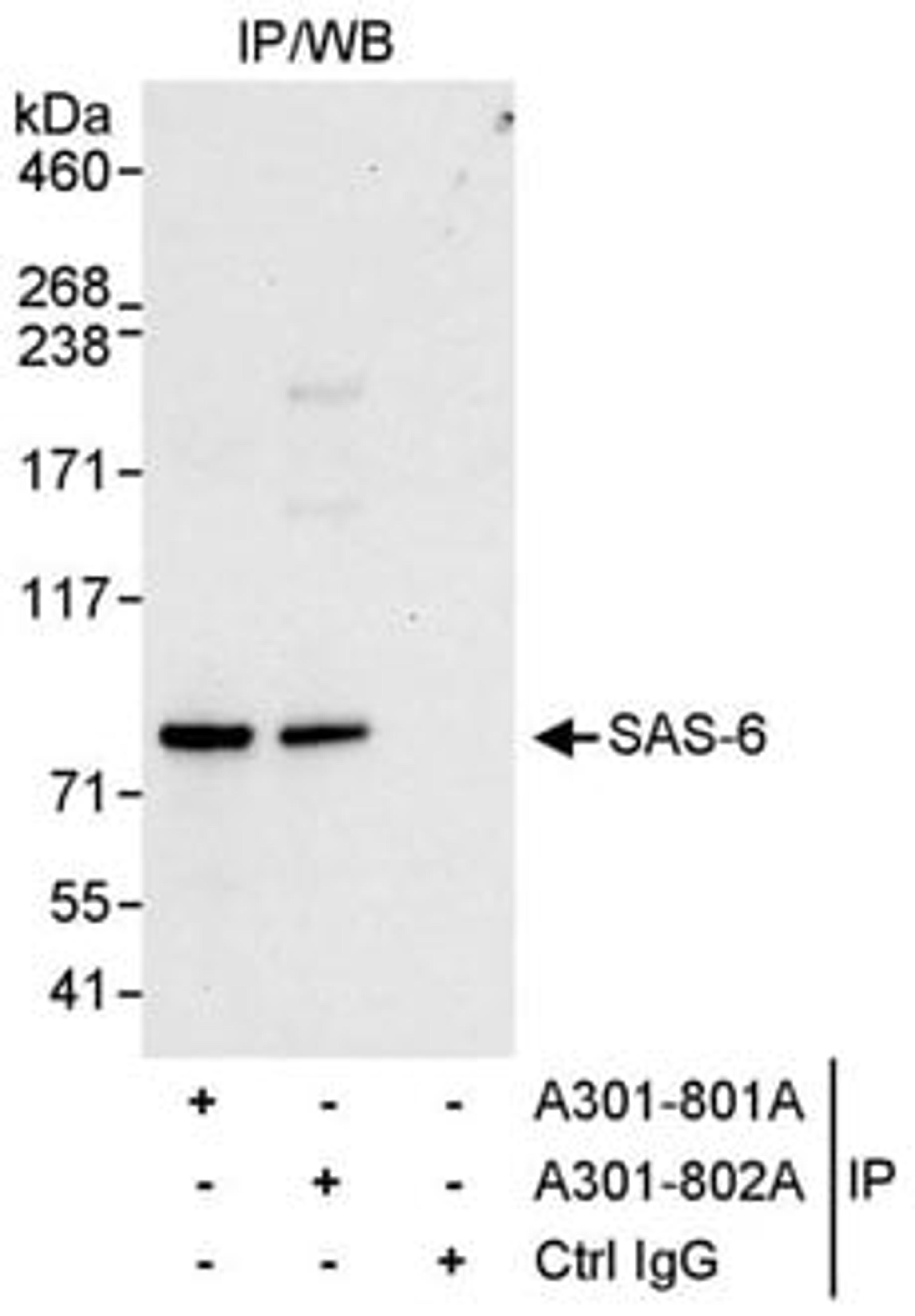 Detection of human SAS-6 by western blot of immunoprecipitates.