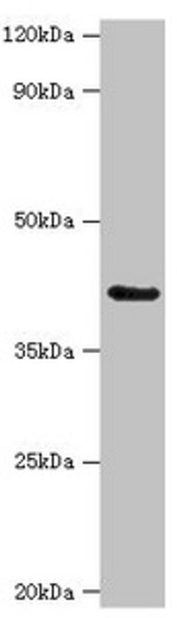 Western blot. All lanes: Serpin B9 antibody at 3ug/ml + K562 whole cell lysate. Secondary. Goat polyclonal to rabbit IgG at 1/10000 dilution. Predicted band size: 42 kDa. Observed band size: 42 kDa. 