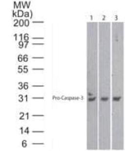 Western Blot: Caspase-3 Antibody (31A1067)  - (Pro and Active) [NB100-56708] - Analysis using the Azide Free version of NB100-56708. Detection of Lanes 1, 2 and 3 demonstrate the species cross-reactivity of the antibody in human, mouse and rat heart lysate, respectively.