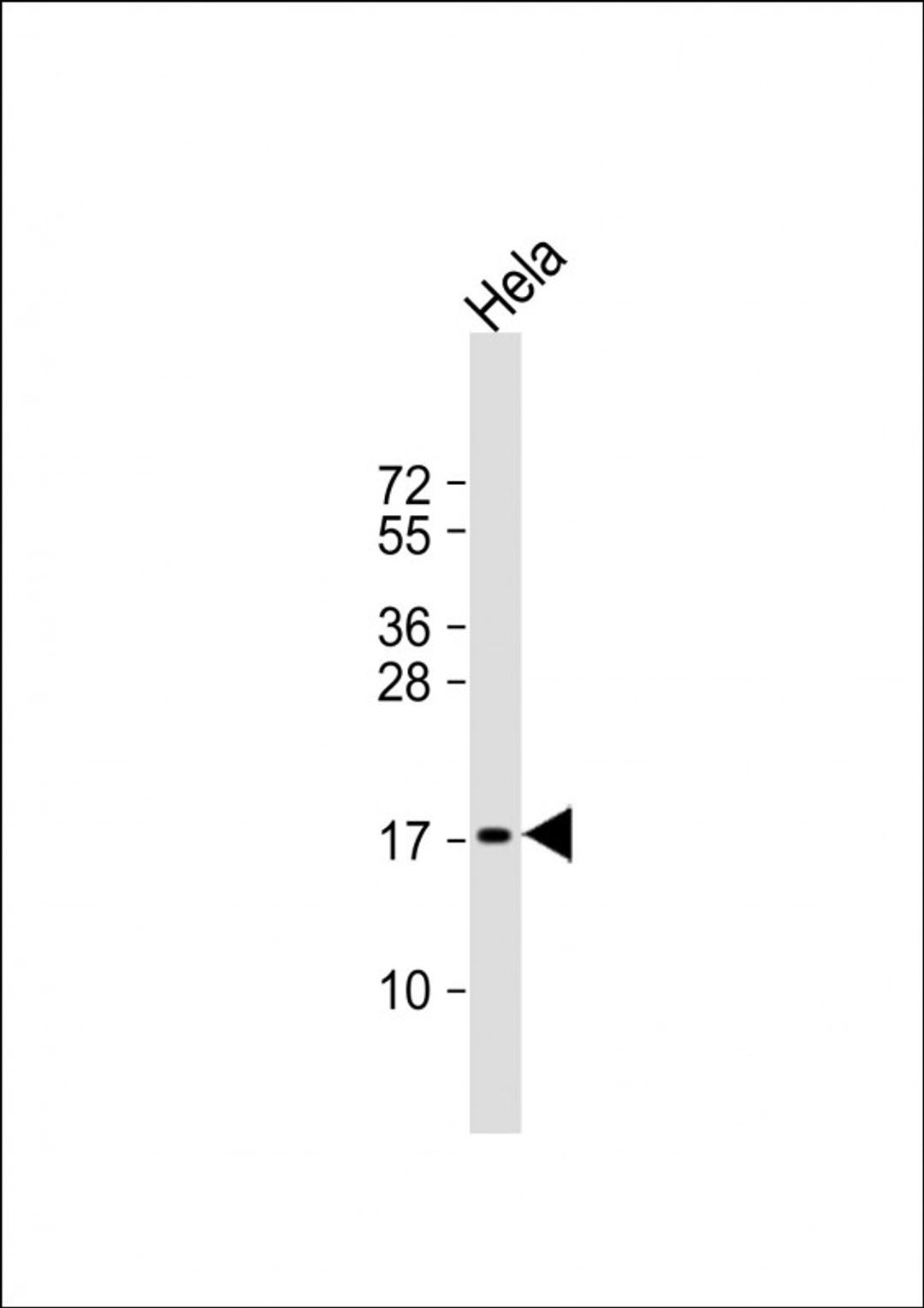 Western Blot at 1:1000 dilution + Hela whole cell lysate Lysates/proteins at 20 ug per lane.