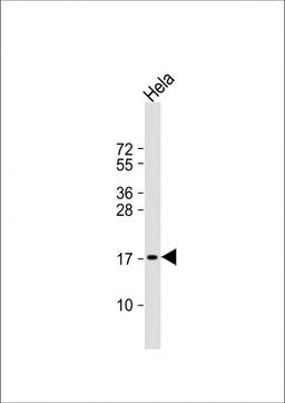 Western Blot at 1:1000 dilution + Hela whole cell lysate Lysates/proteins at 20 ug per lane.