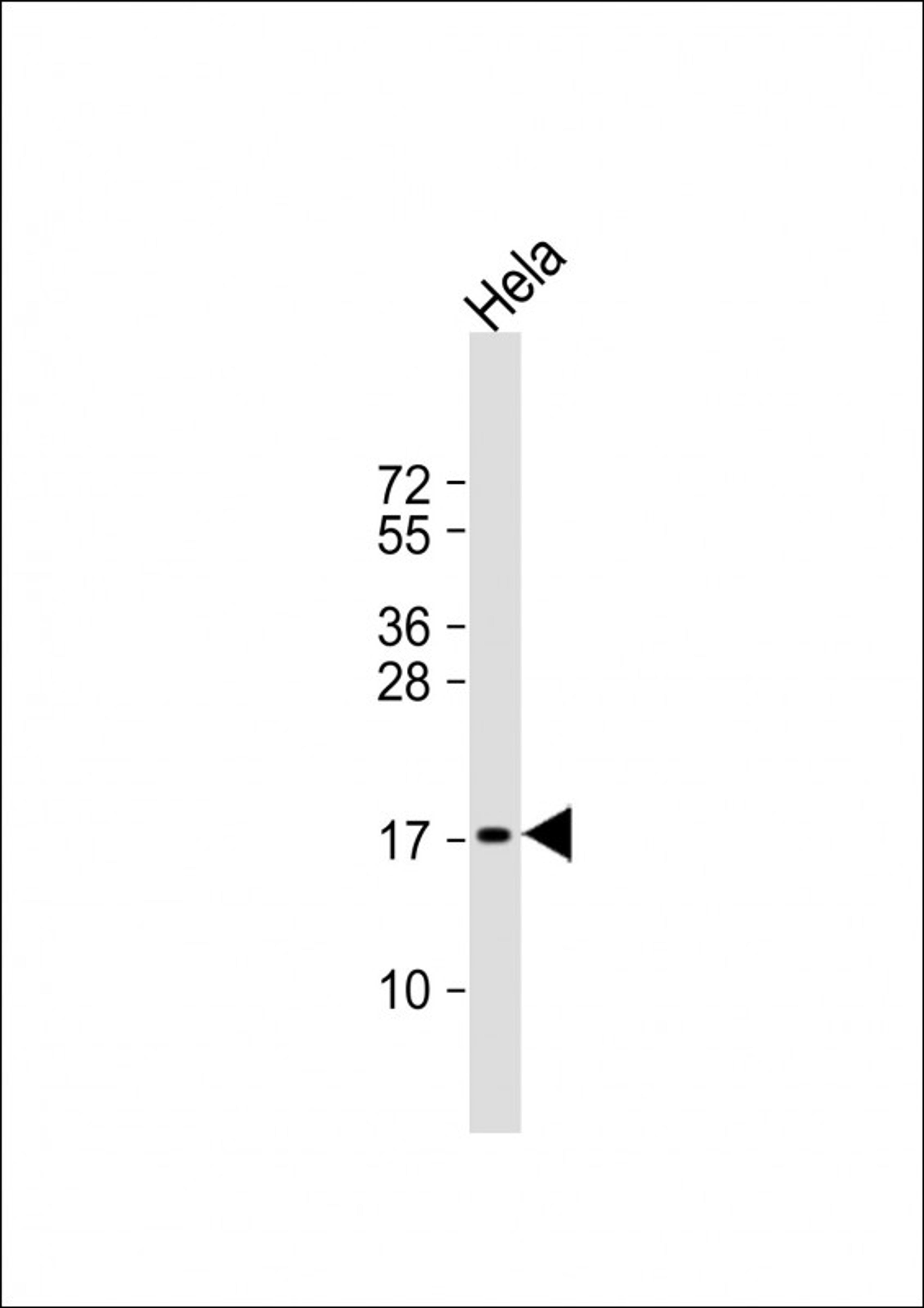 Western Blot at 1:1000 dilution + Hela whole cell lysate Lysates/proteins at 20 ug per lane.