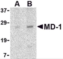 Western blot analysis of MD-1 in Daudi cell lysate with MD-1 antibody at (A) 1 and (B) 2 &#956;g/mL.