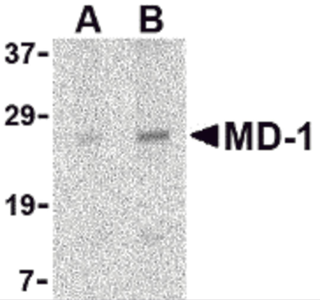 Western blot analysis of MD-1 in Daudi cell lysate with MD-1 antibody at (A) 1 and (B) 2 μg/mL.