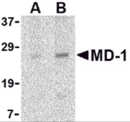 Western blot analysis of MD-1 in Daudi cell lysate with MD-1 antibody at (A) 1 and (B) 2 μg/mL.