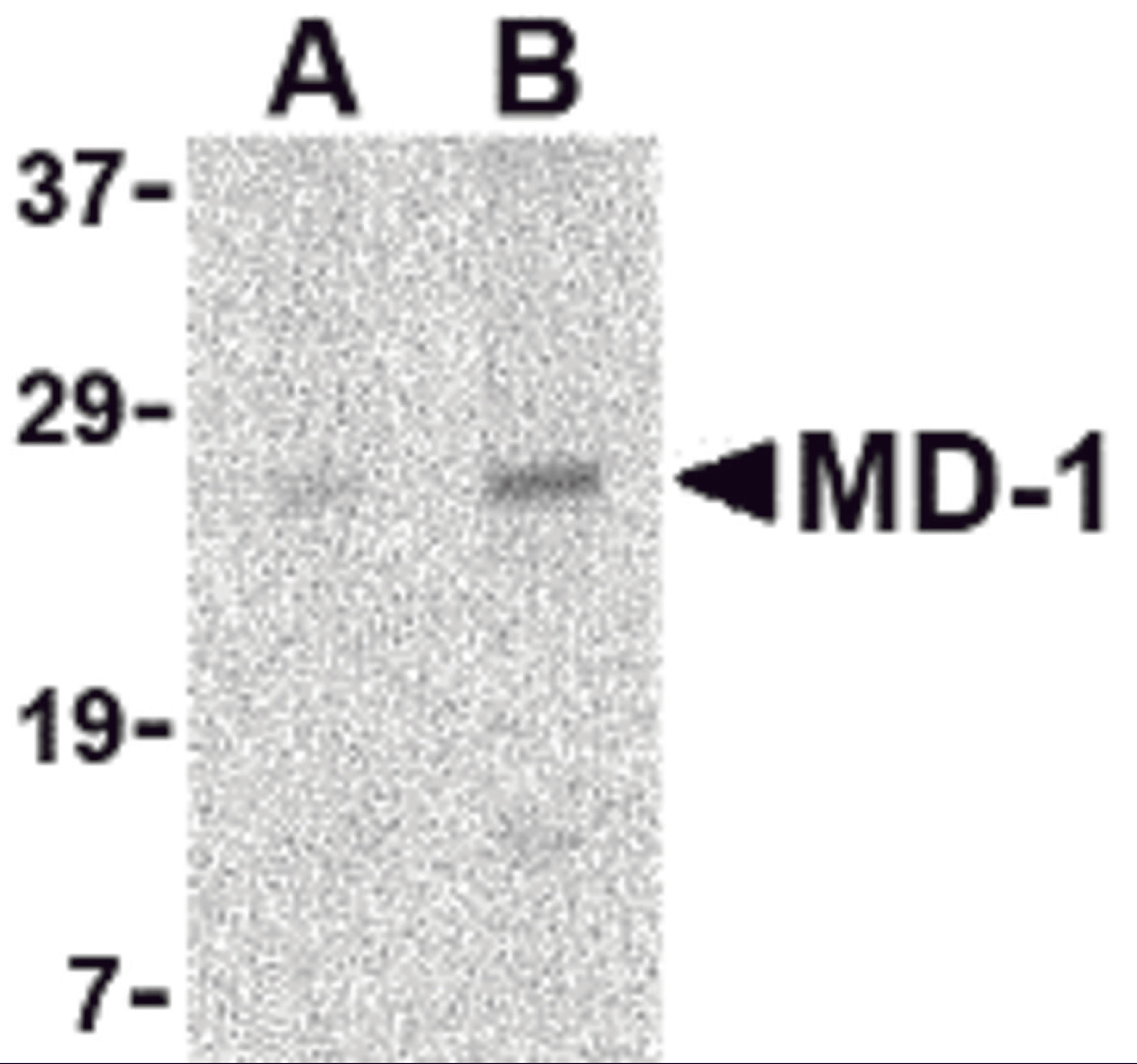 Western blot analysis of MD-1 in Daudi cell lysate with MD-1 antibody at (A) 1 and (B) 2 μg/mL.