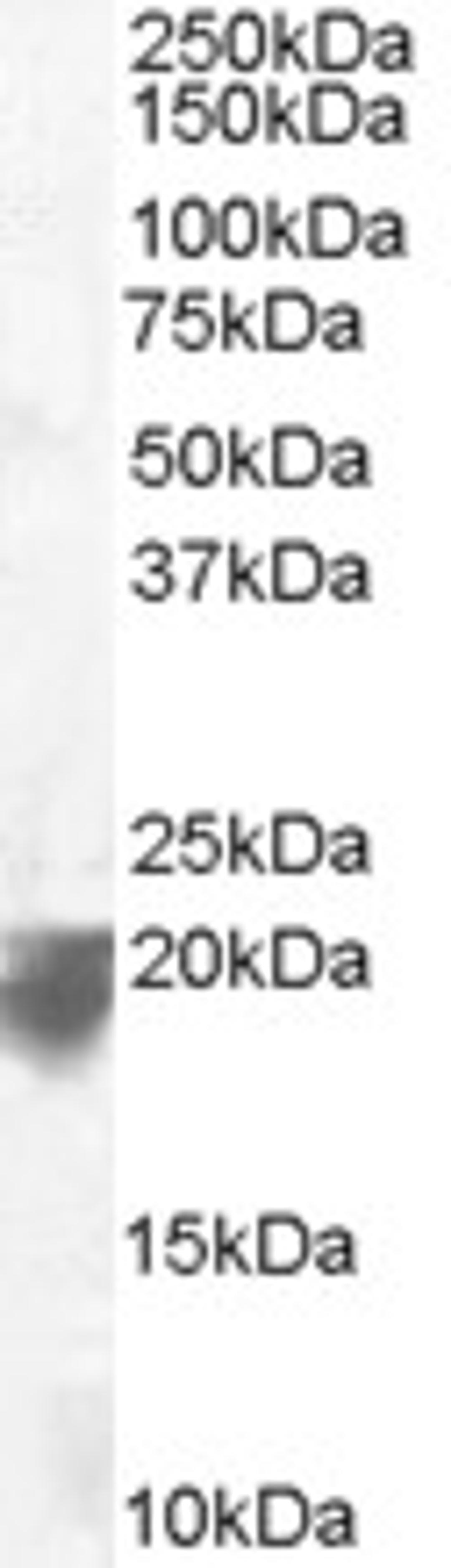 46-581 staining (0.1ug/ml) of Human Spleen lysate (RIPA buffer, 35ug total protein per lane). Primary incubated for 1 hour. Detected by chemiluminescence.