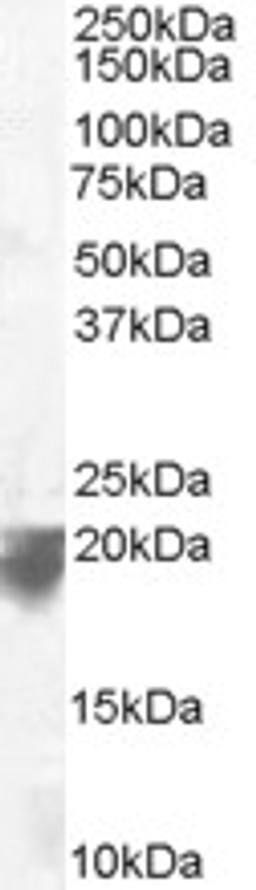 46-581 staining (0.1ug/ml) of Human Spleen lysate (RIPA buffer, 35ug total protein per lane). Primary incubated for 1 hour. Detected by chemiluminescence.