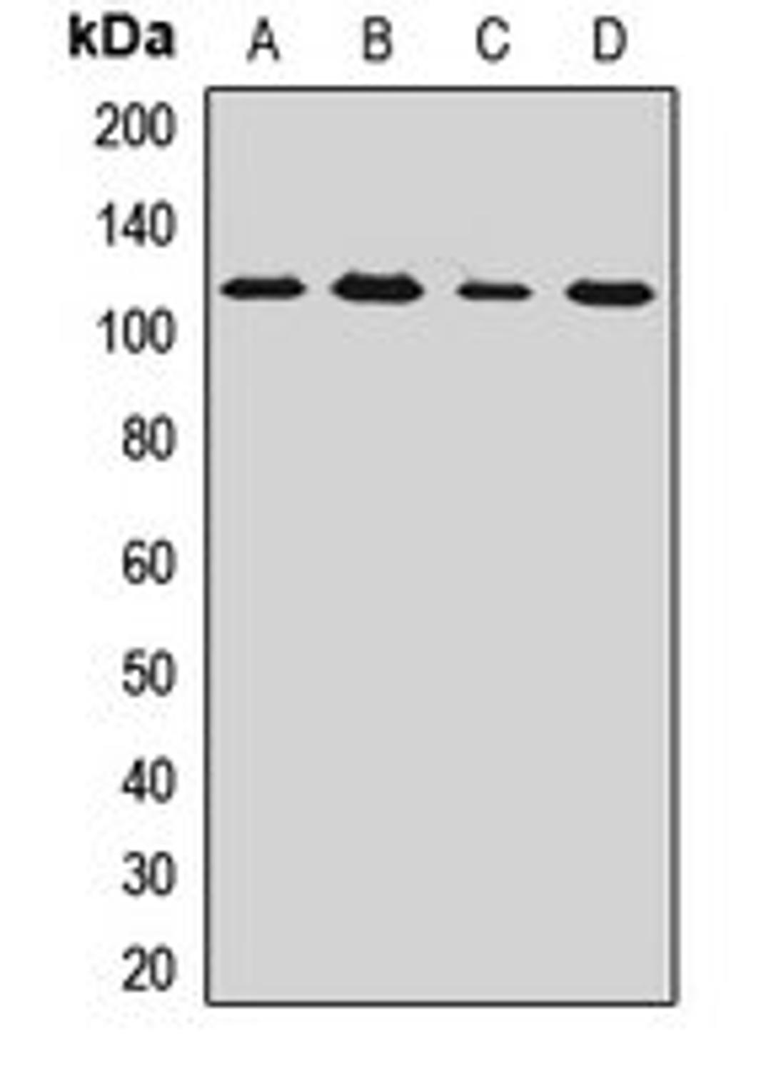 Western blot analysis of A431 (Lane1), Hela (Lane2), mouse brain (Lane3), rat brain (Lane4) whole cell lysates using FAAP100 antibody