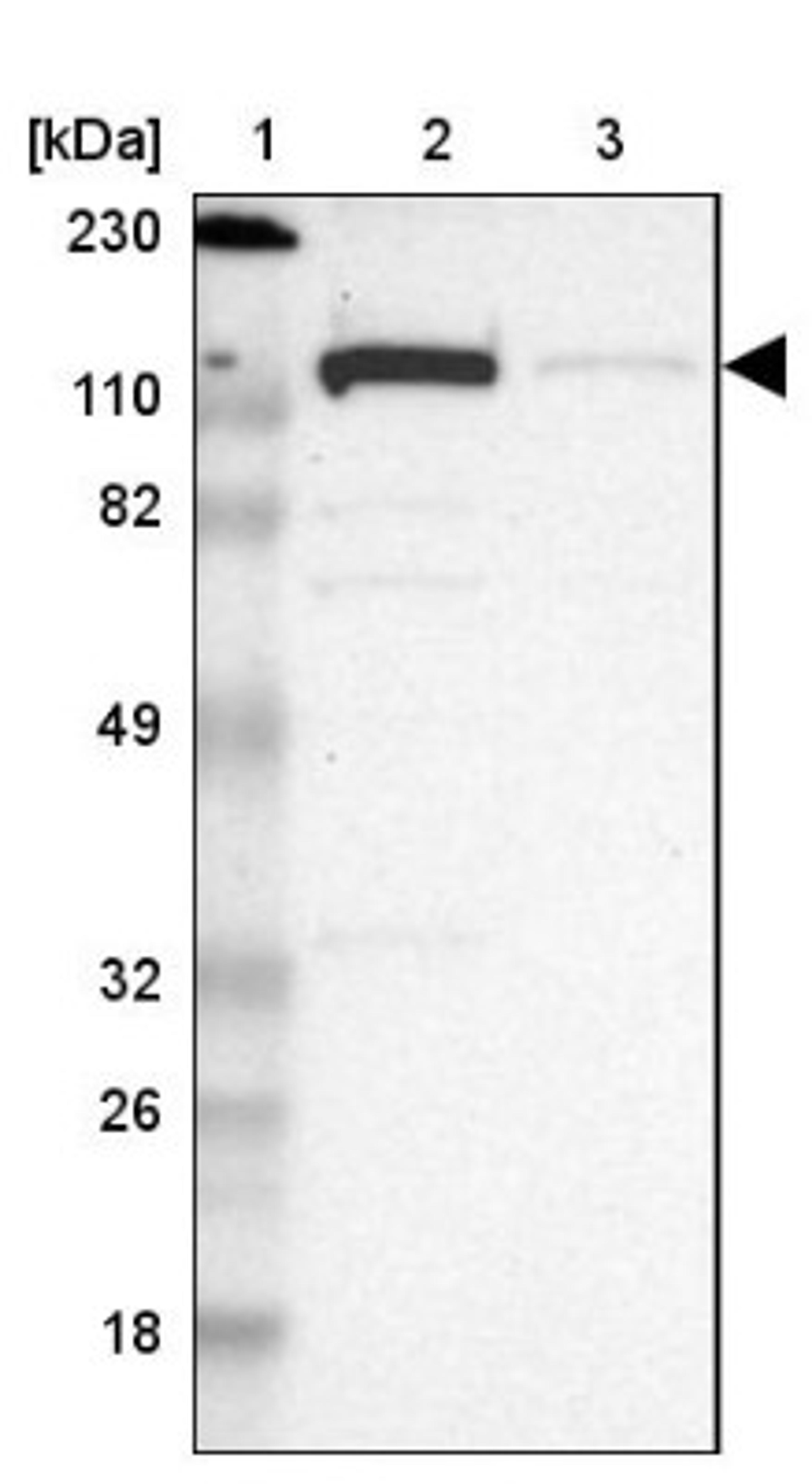 Western Blot: kinectin Antibody [NBP1-90634] - Lane 1: Marker [kDa] 230, 110, 82, 49, 32, 26, 18<br/>Lane 2: Human cell line RT-4<br/>Lane 3: Human cell line U-251MG sp