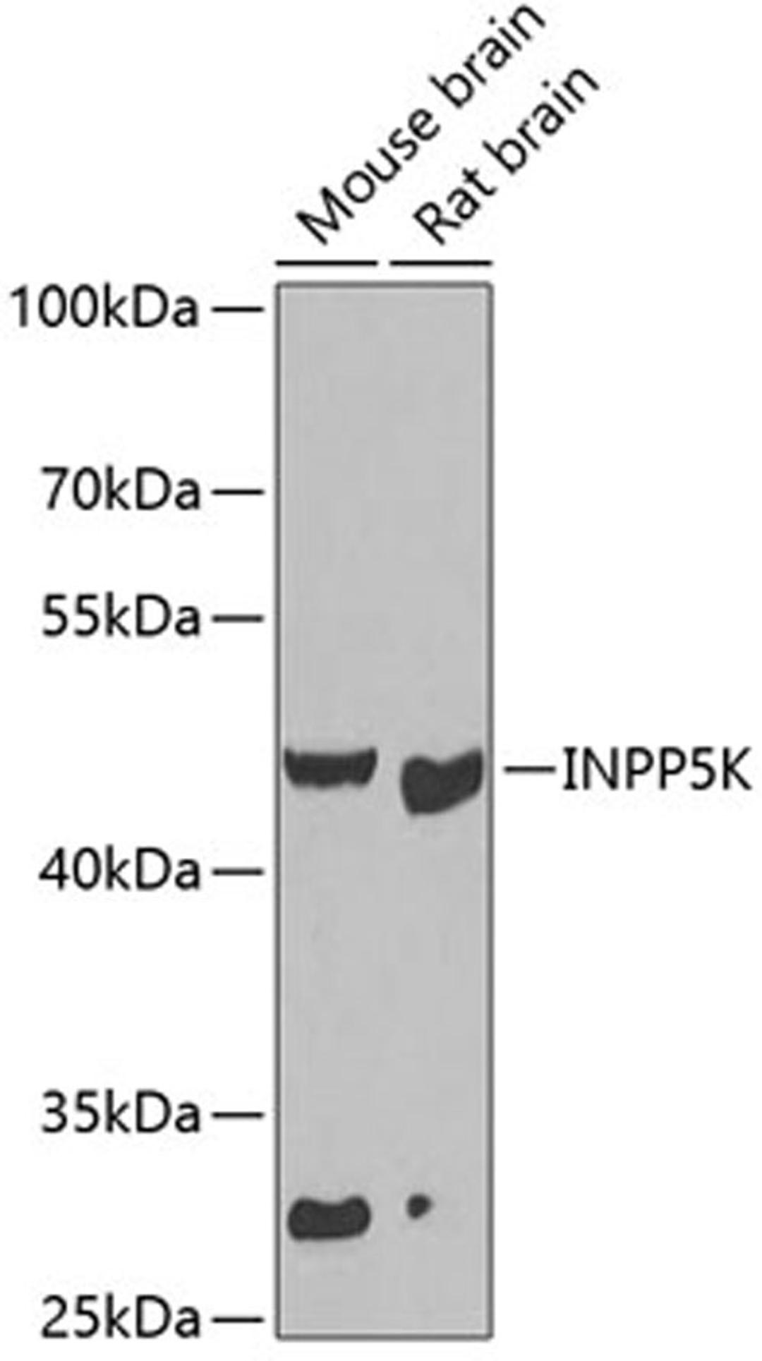 Western blot - INPP5K antibody (A7807)