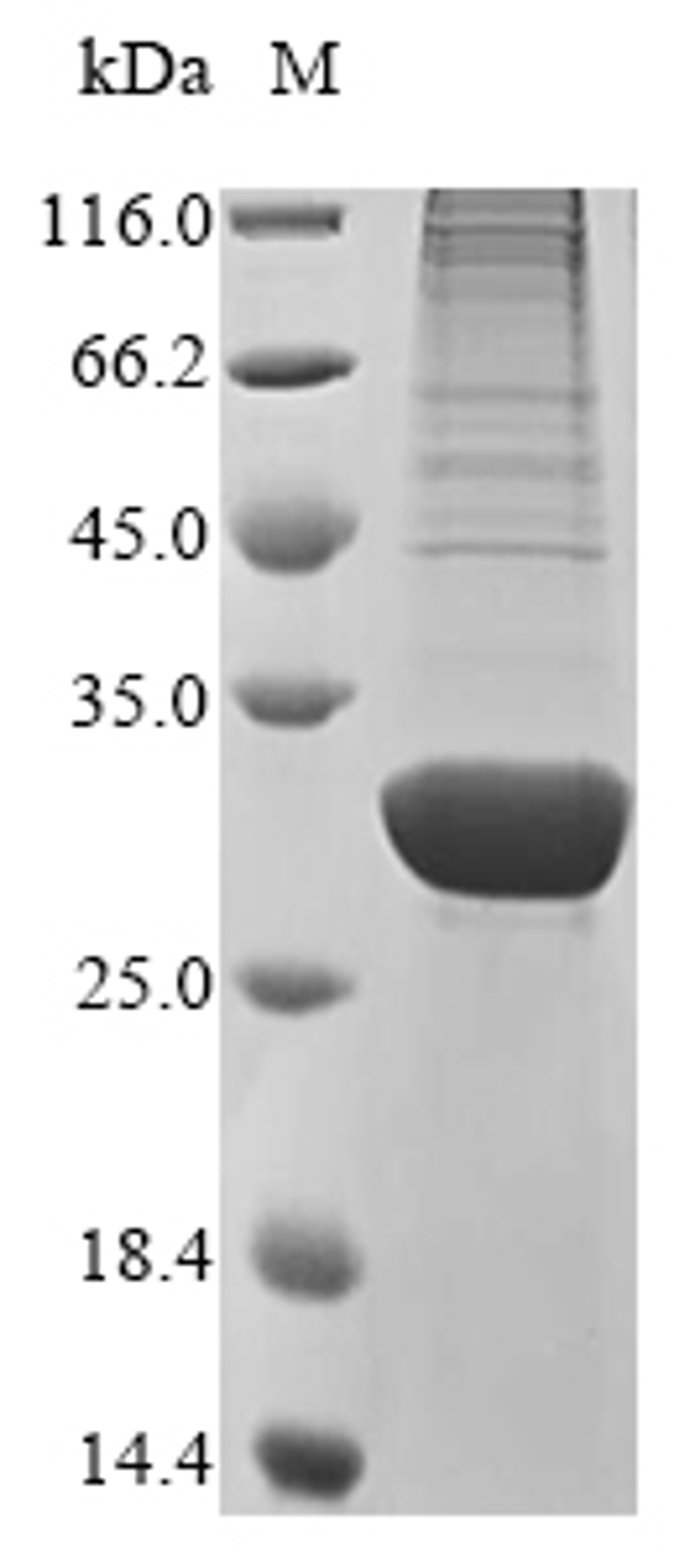 (Tris-Glycine gel) Discontinuous SDS-PAGE (reduced) with 5% enrichment gel and 15% separation gel.