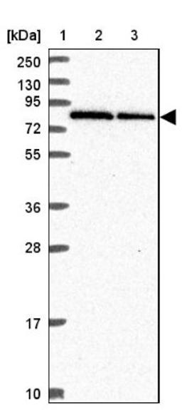 Western Blot: RNF10 Antibody [NBP2-38672] - Lane 1: Marker [kDa] 250, 130, 95, 72, 55, 36, 28, 17, 10<br/>Lane 2: RT-4<br/>Lane 3: U-251 MG