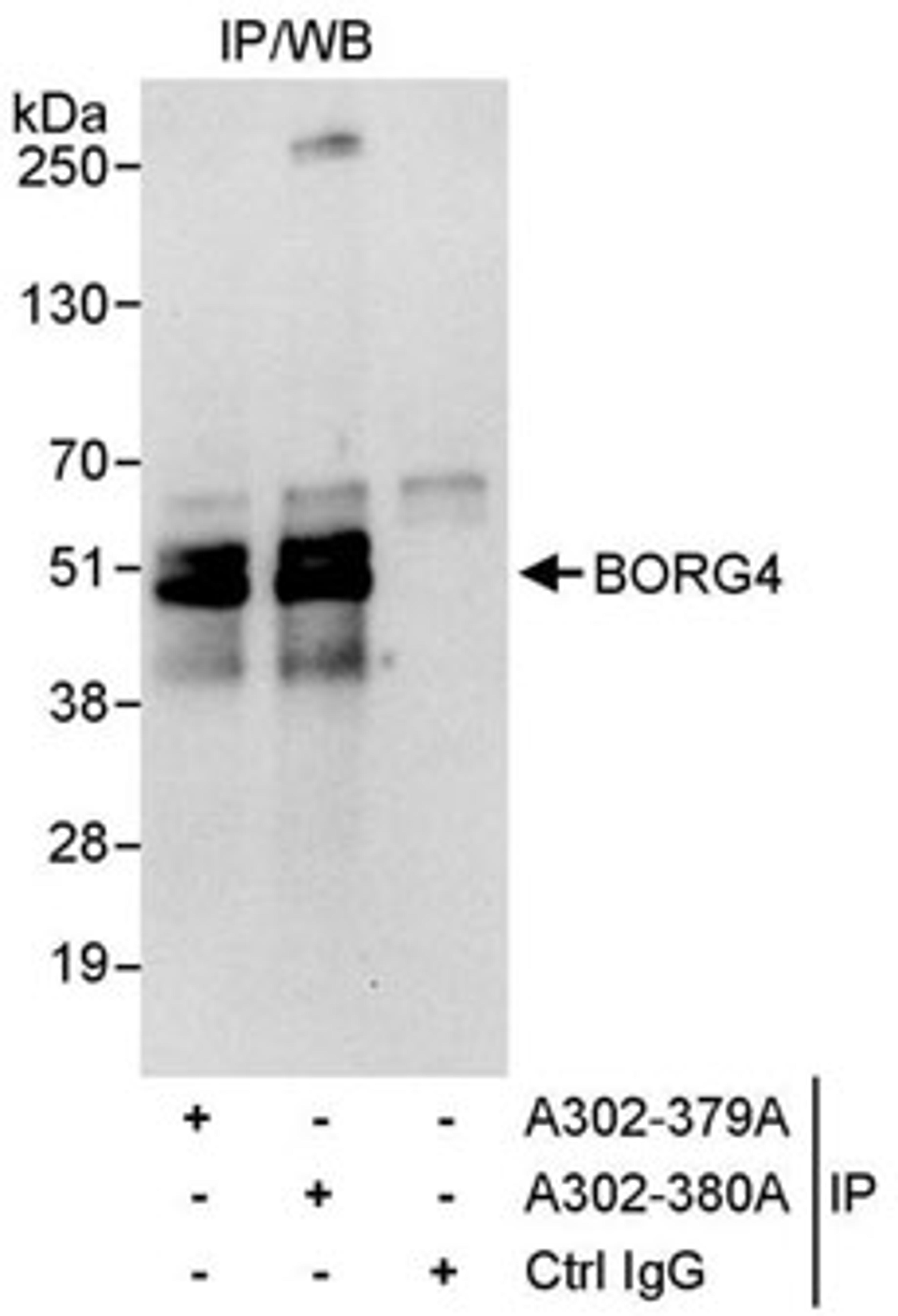 Detection of human BORG4 by western blot of immunoprecipitates.