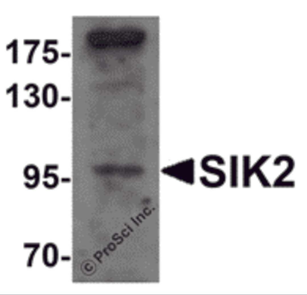 Western blot analysis of SIK2 in SW480 cell lysate with SIK2 antibody at 1 μg/mL.